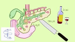 Pancréatite [upl. by Centonze]