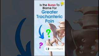 Greater Trochanteric Pain anatomy physiotherapy physicaltherapy gtps hippain [upl. by Suraved]