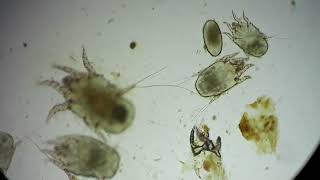 Ear Mites in a Cat Otodectes cynotis [upl. by Aikemit810]