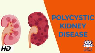 Polycystic kidney Disease Causes Signs and Symptoms Diagnosis and Treatment [upl. by Calabrese31]