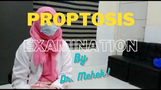 Proptosis Examination [upl. by Elwina]