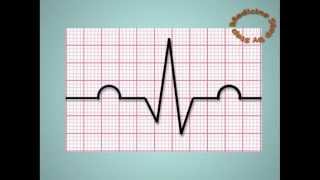 Understanding ECGs  EKG [upl. by Reynold]