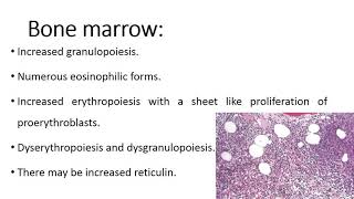 Myeloid lymphoid neoplasms with PCM1 JAK2 [upl. by Nanfa122]