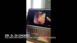 Wow IntraOral Scanner Full Arch [upl. by Milstone]