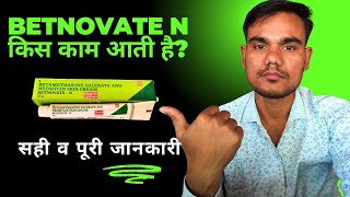 betnovate n lagane se kya hota hai  betnovate n skin cream ke fayde [upl. by Enelear]