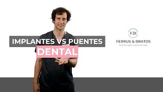 ¿PUENTE O IMPLANTE DENTAL 🦷 Te cuento las DIFERENCIAS y VENTAJAS de cada uno [upl. by Block]