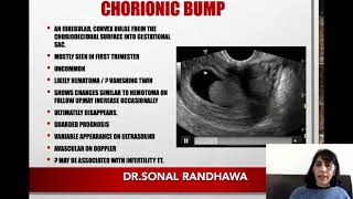 Chorionic bump [upl. by Godber]