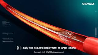 Genoss Peripheral Stent System [upl. by Cummings]