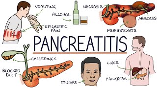 Understanding Pancreatitis [upl. by Anitnuahs]