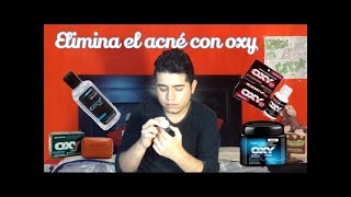 Elimina el acné con oxy [upl. by Oj308]