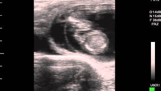 Bovine Pregnancy 60 day Twins deceased  ultrasound [upl. by Aisela35]