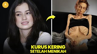 Jarang Tersorot Tubuh 6 artis senior berubah drastis setelah menikah [upl. by Rockie]