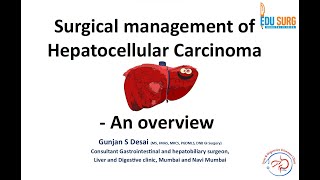 Primary liver cancer  Hepatocellular carcinoma treatment  Dr Gunjan Desai  Edusurg Clinics [upl. by Rauch]