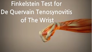 Finkelsteins Test Unveiling Thumb Tendon Trouble Finkenstein 검사 손목 건초염의 숨은 진실 [upl. by Nogem]