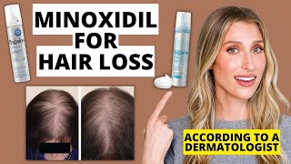 Dermatologist Explains How Minoxidil Works for Hair Loss How to Use Results amp More [upl. by Winchell38]