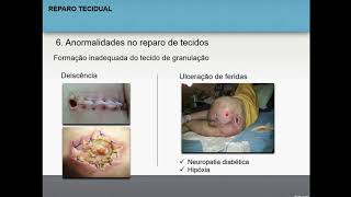 Reparo tecidual  Patologia geral 55 [upl. by Jeanne]