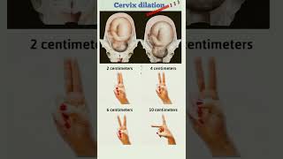 🤰🤰 Dilation of cervix 🤰🤰👩‍⚕️👩‍⚕️ [upl. by Tenaej45]