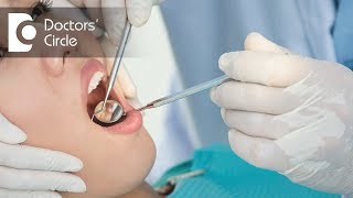 How to manange Pericoronitis amp pain due to it  Dr Arundati Krishnaraj [upl. by Claudio]