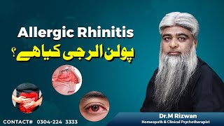 Allergic Rhinitis [upl. by Zeeba]