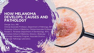 How Melanoma Develops Causes and Pathology [upl. by Dadirac130]