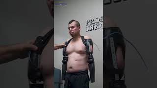 Victor Bilateral TransHumeral Prosthetic Elbow Placement  Prosthetic Innovations [upl. by Ahouh]