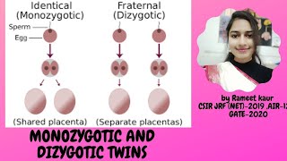 Monozygotic and Dizygotic twins [upl. by Melly]