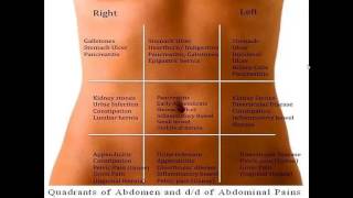 Differential diagnosis of abdominal pain according to abdominal regions [upl. by Garnette897]