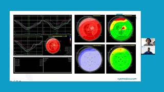 Webinar Interpretación de curvas de Strain Miocárdico [upl. by Oringas]