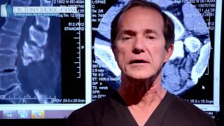 Epidural Steroid For Lumbar Spinal Stenosis Pros and Cons by Dr Tony Mork [upl. by Jakoba]