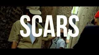 Scars  CCG AON Exclusive  Prod amp Shot by DjKennAON [upl. by Salinas]