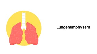 Lungenemphysem  Erkrankungen der Atemwege [upl. by Hgiellek]