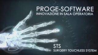 STS Surgery Touchless System in chirurgia maxillofacciale [upl. by Noyek]