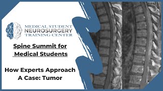 Spine Summit for Medical Students How Experts Approach A Case Tumor [upl. by Amorete]