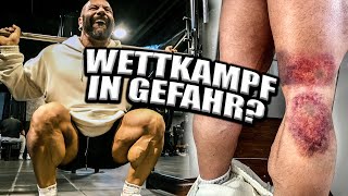 NEW YORK in GEFAHR Beintraining mit Verletzung 4 WEEKS OUT [upl. by Ecnerolf]