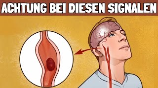 Vor einem Schlaganfall sendet dir dein Körper diese Signale [upl. by Ciredec]