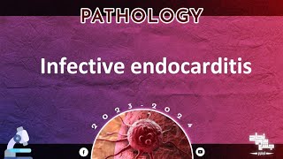 L3 part2 Infective endocarditis Pathology [upl. by Charissa]