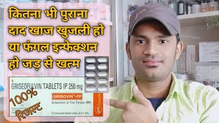 Grisovin fp 250 tablet use dose benefits side effects full review in hindi पुरी जानकारी हिन्दी में [upl. by Mccartan]