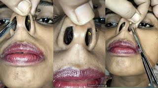 Nose hair cutting and nose massagepignosenosehaircutting nosemassage pummybeautyworld [upl. by Lock]