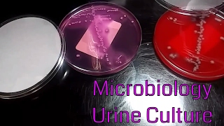 Urine Culture Microbiology Video 2 [upl. by Kaia]