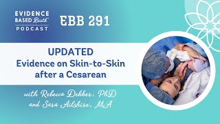 Evidence on Skin to Skin Care after a Cesarean [upl. by Cord]