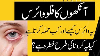 Eyes Flu Virus in Pakistan  Symptoms Impacts Spread and Solution of EyeFluVirus [upl. by Imehon310]