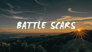 My Song  Battle Scars [upl. by Gault895]