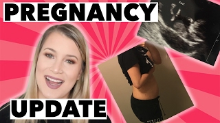 13 WEEK PREGNANCY UPDATE [upl. by Gish726]