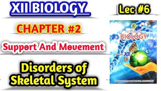 Disorders of Skeletal system lec 6 class 12 biology new book [upl. by Charlotta]