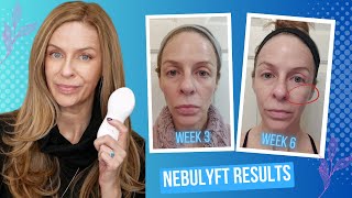 Skin Tightening Results  What I Learned Using Nebulyft R2 3X Per Week vs Daily Use [upl. by Leone653]