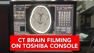 CT Brain filming on console of 16 slice toshiba [upl. by Sheya]