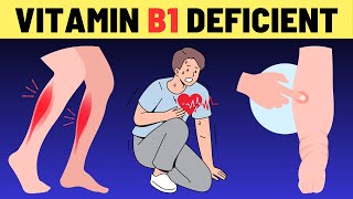 10 Signs You Are DEFICIENT in VITAMIN B1 Thiamine Deficiency Signs Symptoms  VisitJoy [upl. by Scurlock]