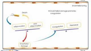 Sepsis development and progression [upl. by Mharba]