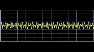 Q Fever Coxiella burnetiiRickettsia  Rife Frequencies [upl. by Omari]