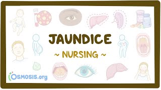 Jaundice Clinical Nursing Care [upl. by Neidhardt224]